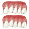 Dental grafting for a healthy smile
