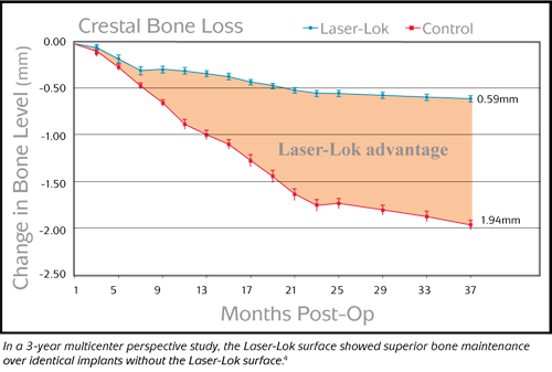 The clinical advantage Laser Lok